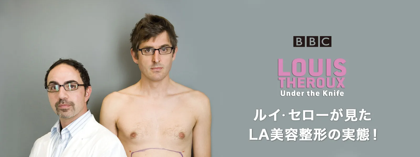 ルイ･セローが見た LA美容整形の実態! - サムネイル