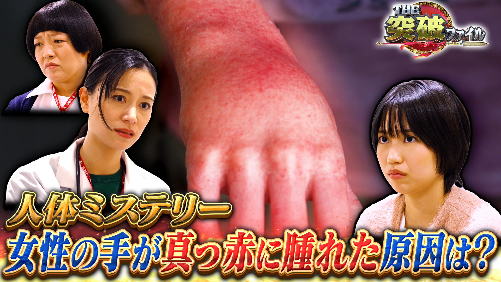 手から足へ移動する謎の腫れ!? 人体ミステリー&刃物強盗VS丸腰バイト